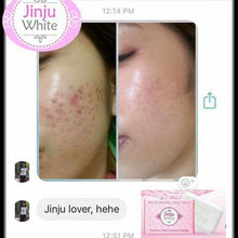 JINJU WHITE SOAP (face & body)