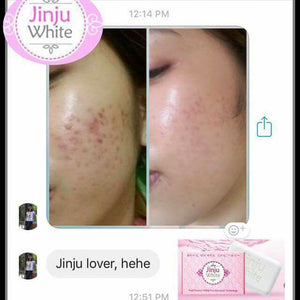 JINJU WHITE SOAP (face & body)