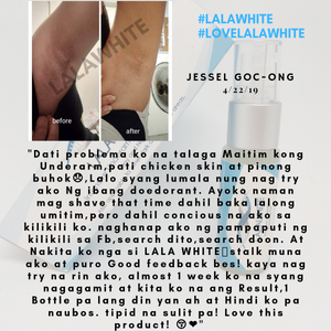 LALAWHITE  WHITENING DEO